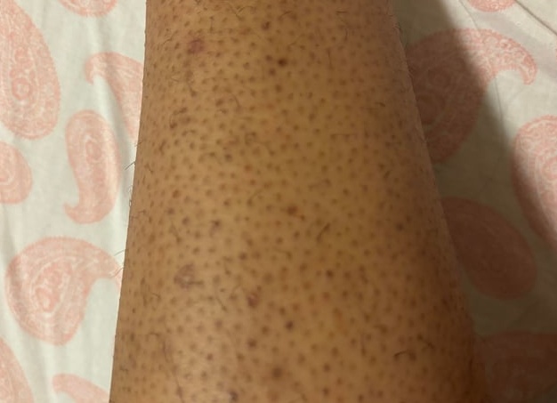 Перестала мучить себя тесным бельем и нашла идеальную одежду для активной жизни и спорта